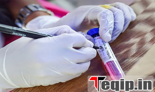 RT PCR Test COVID 19 Report Online Download