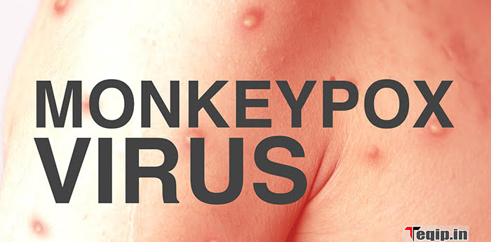 Monkeypox virus 