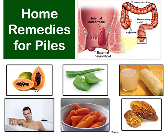 Piles Treatment At Home In Bleeding In Hindi