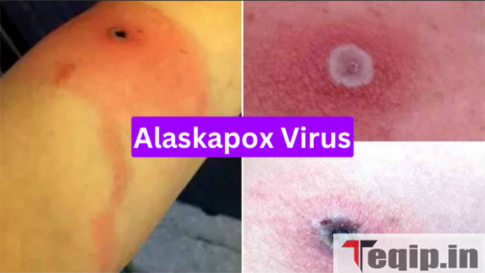 Alaskapox Virus